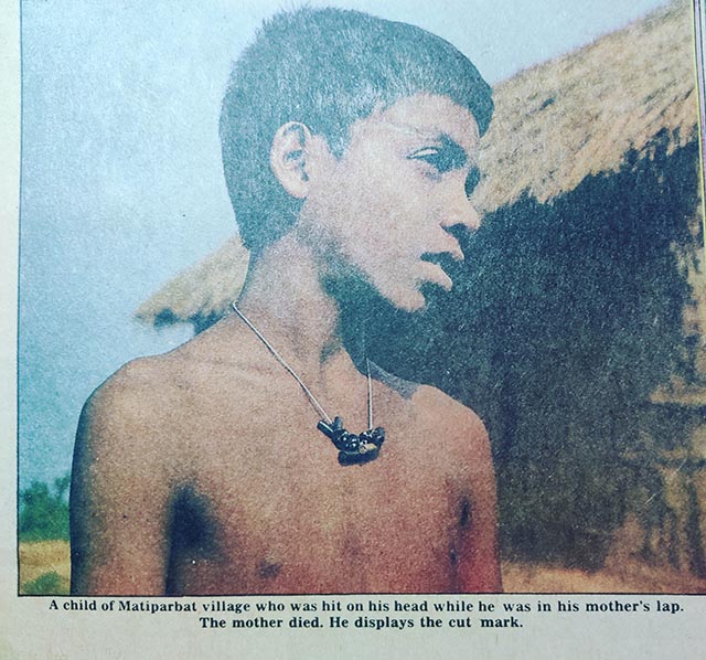 A child injured during the Nellie massacre